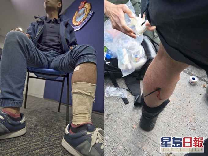 去年，有警员在理大附近被暴徒持箭射中小腿（图片来源：《星岛日报》）